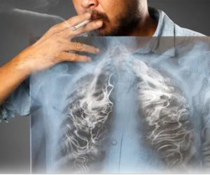 Smoking Cessation in Delhi